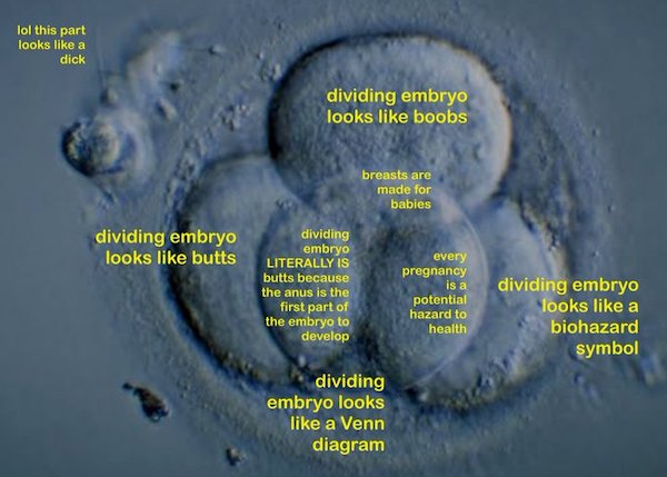image of a dividing embryo, with four overlapping circles labeled like a Venn diagram: dividing embryo looks like boobs / dividing embryo looks like butts / dividing embryo looks like a biohazard symbol / dividing embryo looks like a Venn diagram / it's also labeled where the Looks Like A Venn Diagram circle overlaps with the others: / butts: dividing embryo LITERALLY IS butts because the anus is the first part of the embryo to develop / boobs: breasts are made for babies / biohazard: every pregnancy is a potential hazard to health / a little blob of cellular tissue off to the side: lol this part looks like a dick